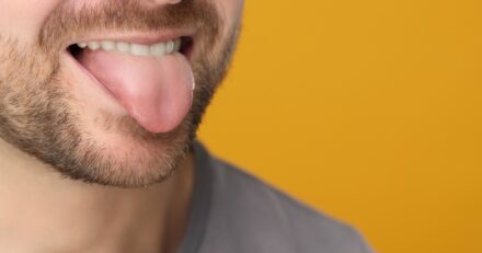 The AI doc will see your tongue now – and tell you what’s wrong with you